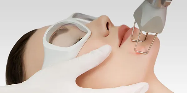 Fractional CO? Laser