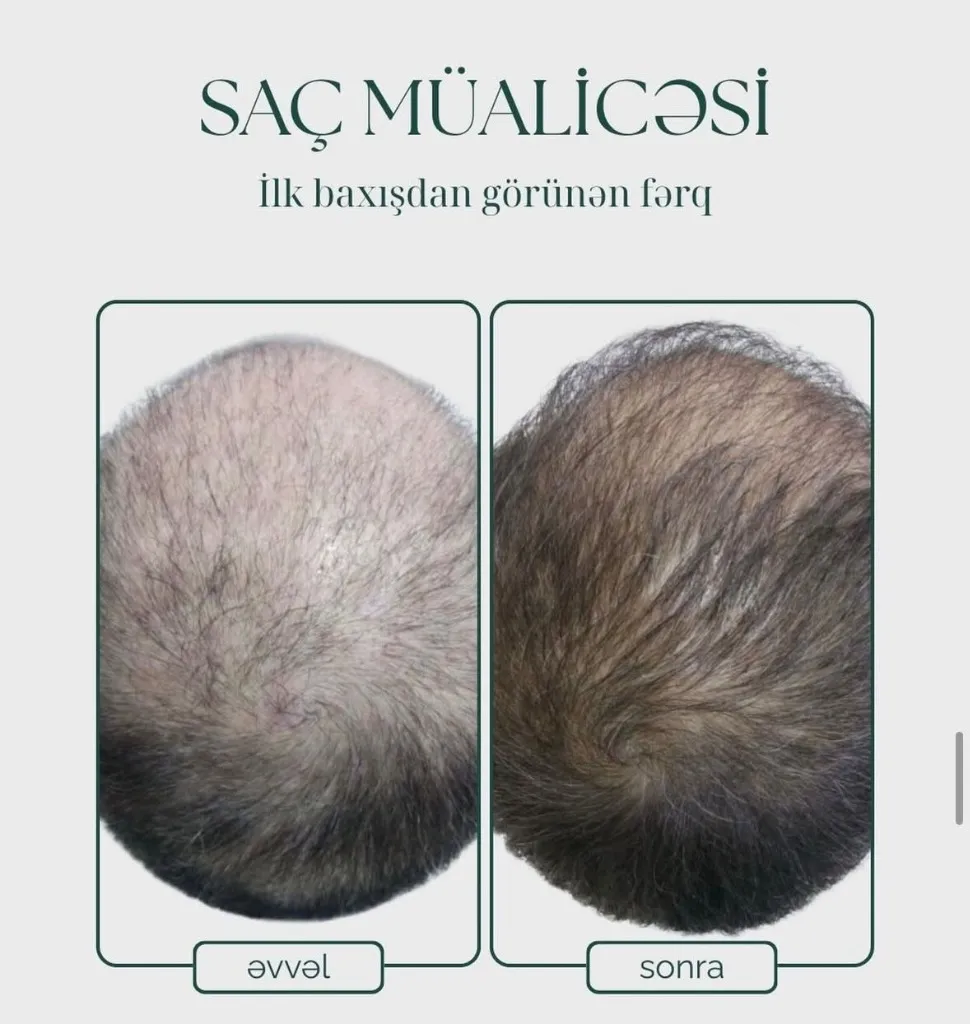 Hair Treatment (2)