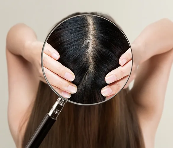 Reactivation of Hair Follicles